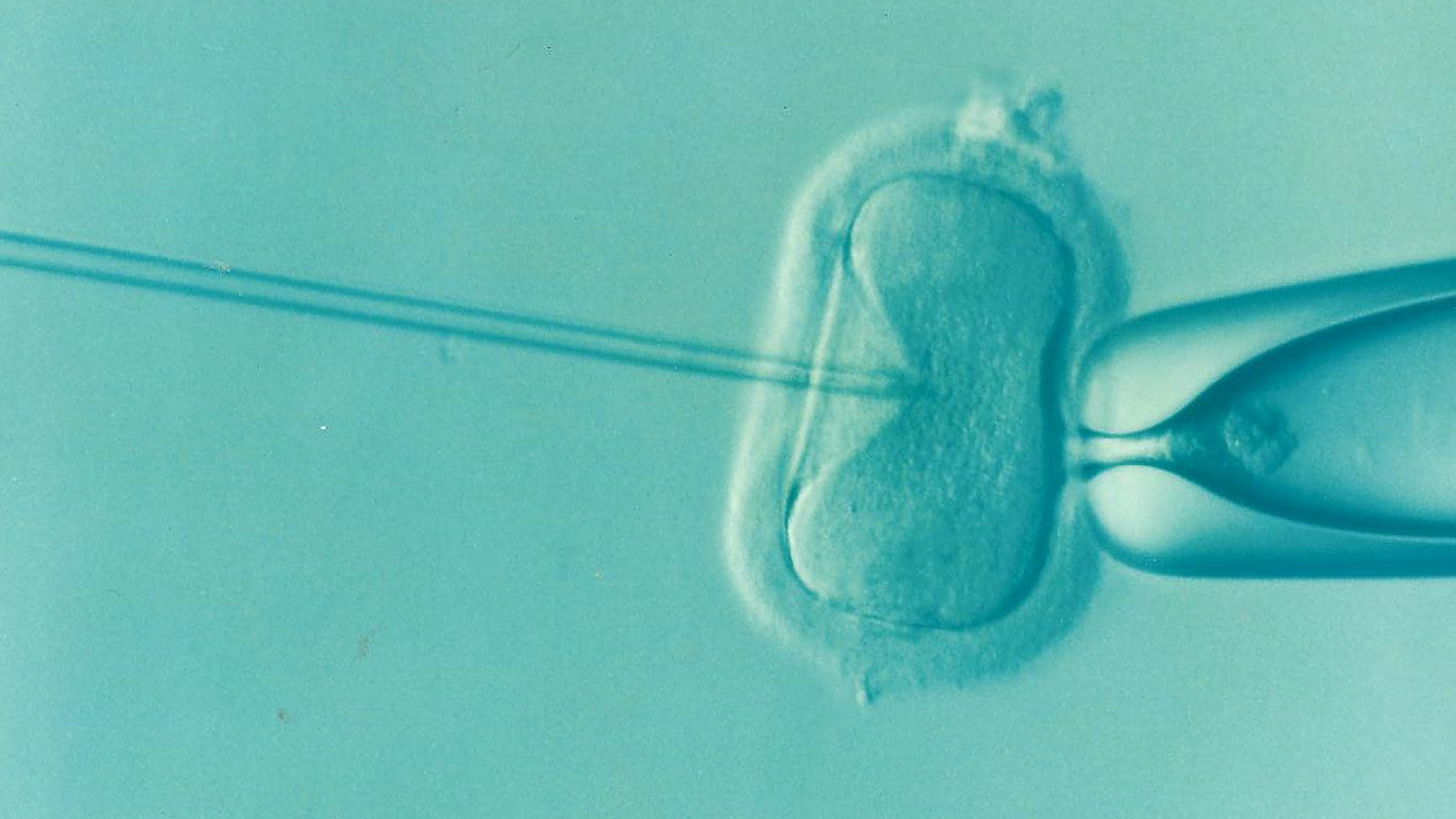 Inseminação FIV ICSI