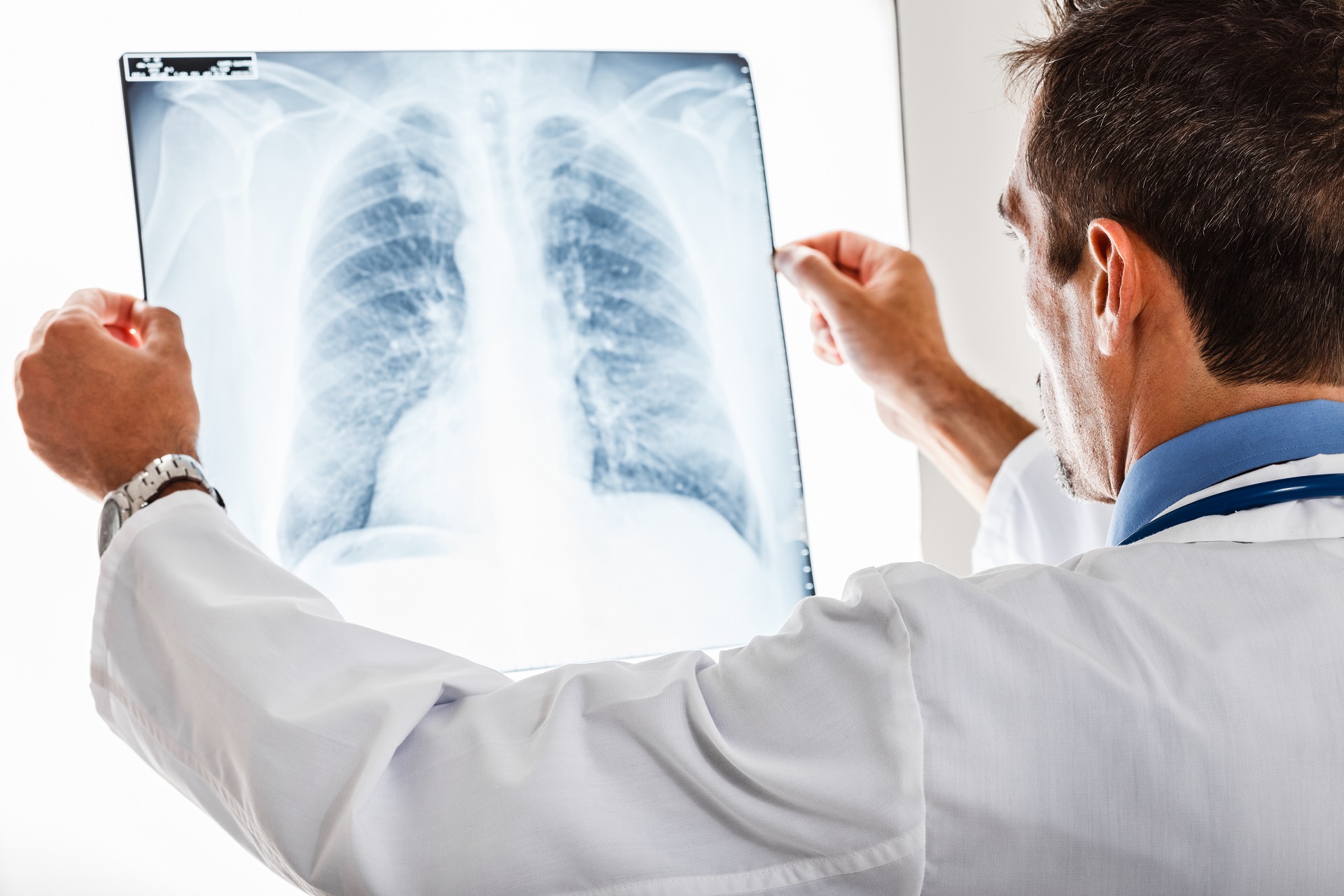 Síndrome de Kartagener, discinesia ciliar primária: infeções respiratórias, inversão dos órgãos, situs inversus totalis e dificuldade para engravidar