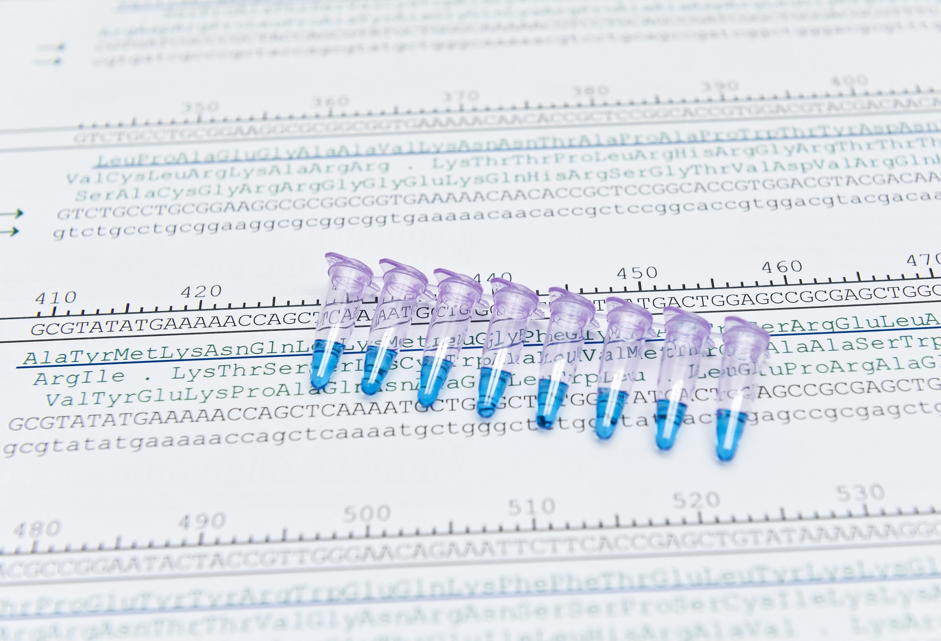 Fenômeno da antecipação expansão de tripletos doença de Huntington Ataxia Hereditária Síndrome do X-frágil