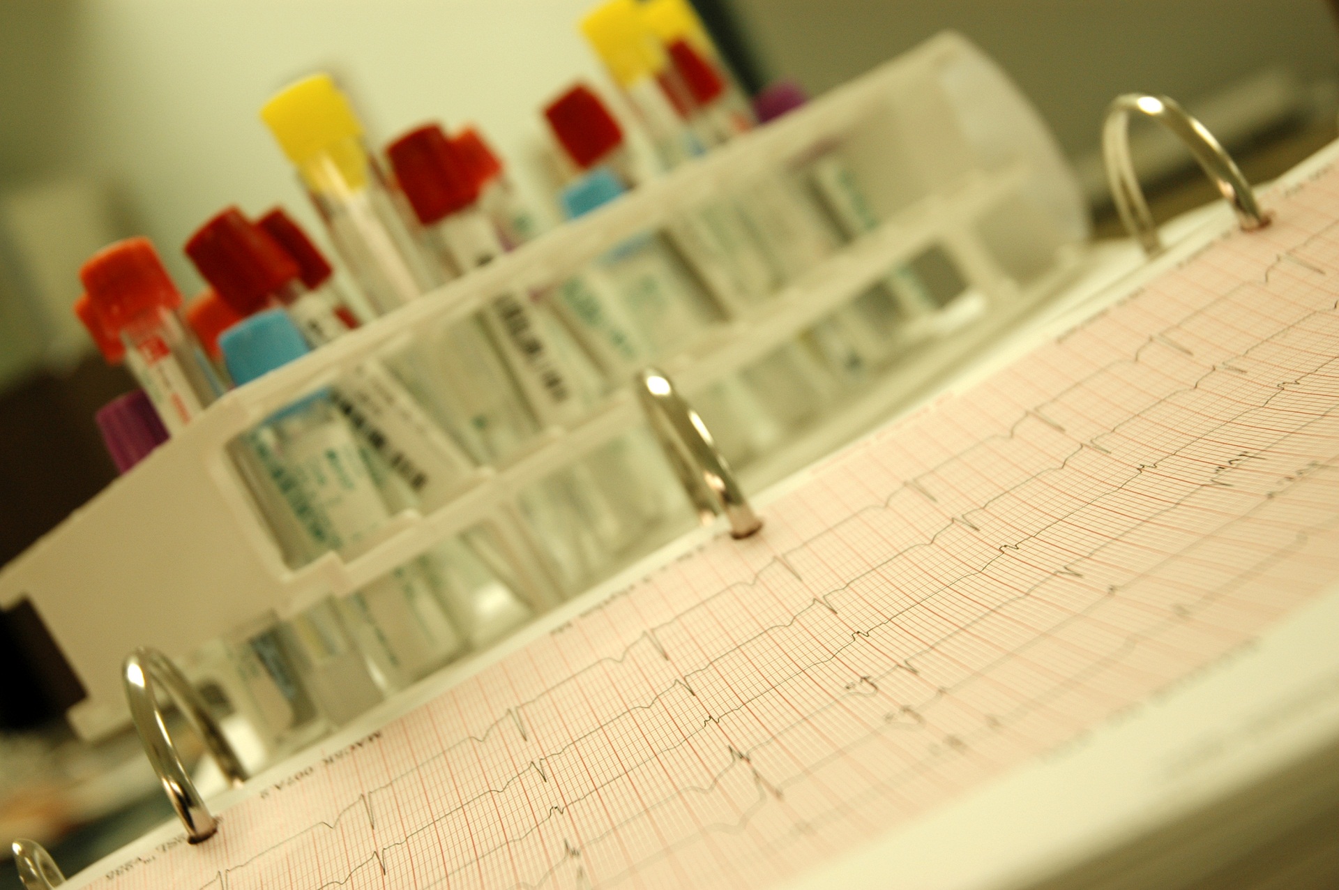 Teste genético riscos e limitações coleta do material coleta de sangue esfregaço bucal amniocentese semen alterações psicossociais informação genética